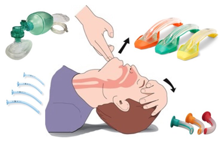 airway-picture